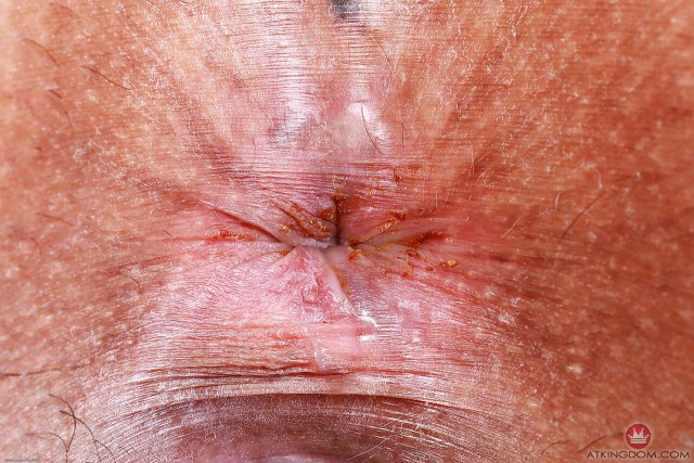 Elegant teen Ameena Green exposing twat