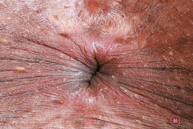 Black teen Rhae Woods spreading legs